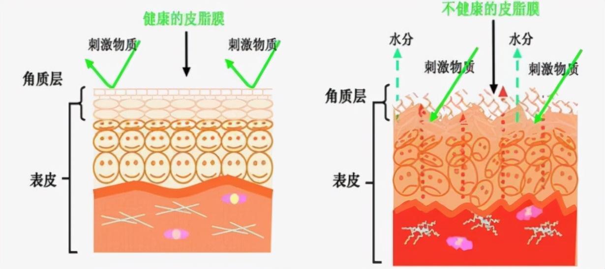 儿童食物过敏急救处理指南