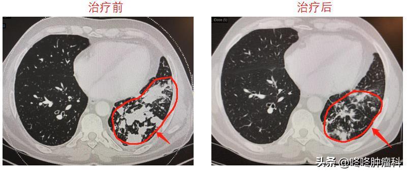 临床研究招募广告模板，引领医学进步的关键一环启动招募活动！